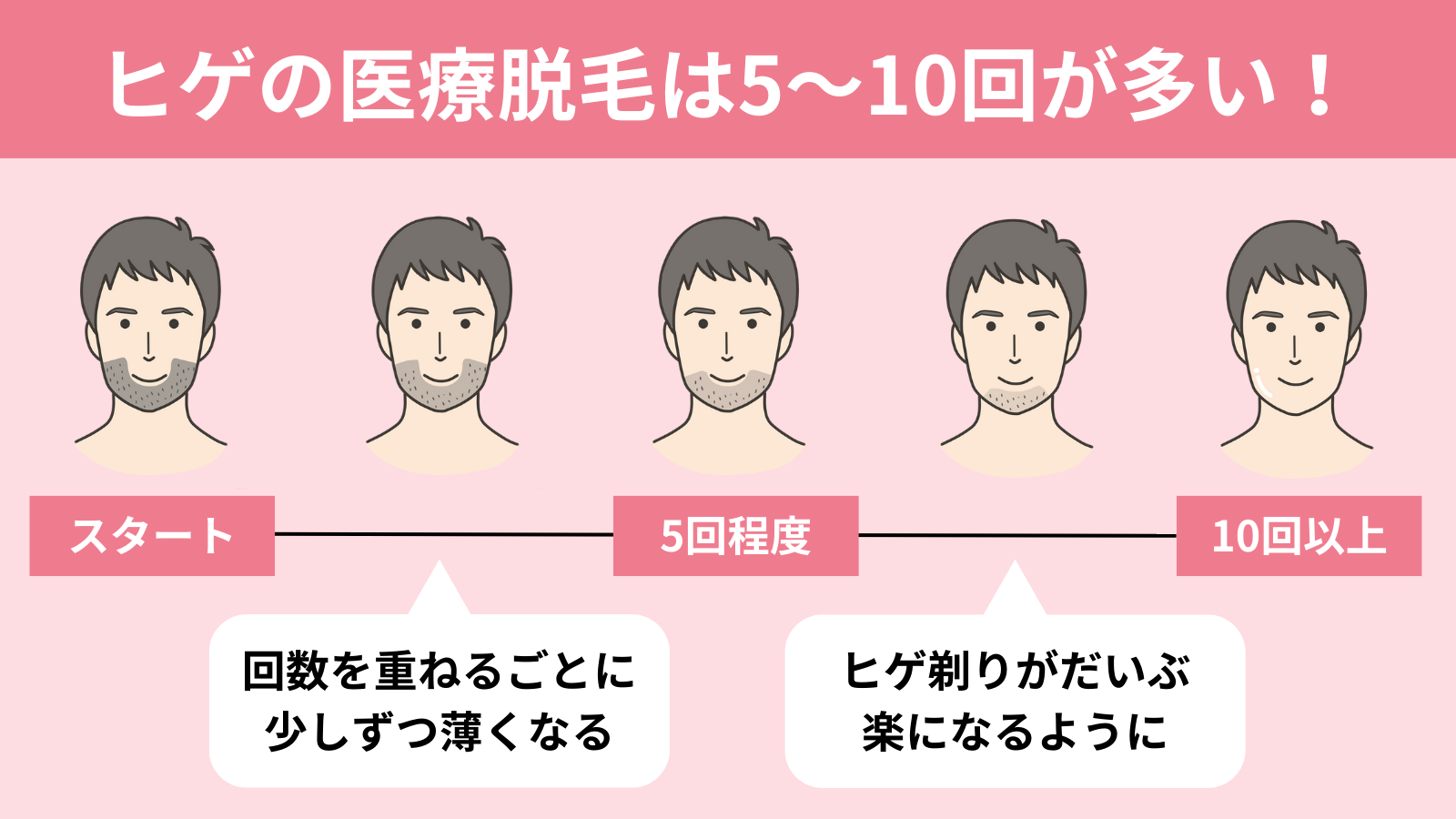 ヒゲの医療脱毛の回数