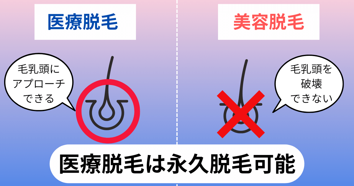 医療脱毛は永久脱毛できる