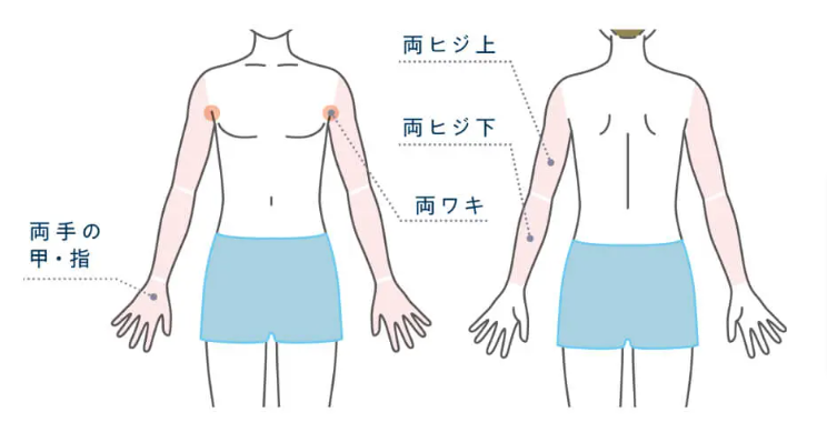 メンズじぶんクリニックの腕脱毛