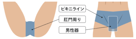 レジーナクリニックオムのVIO脱毛部位