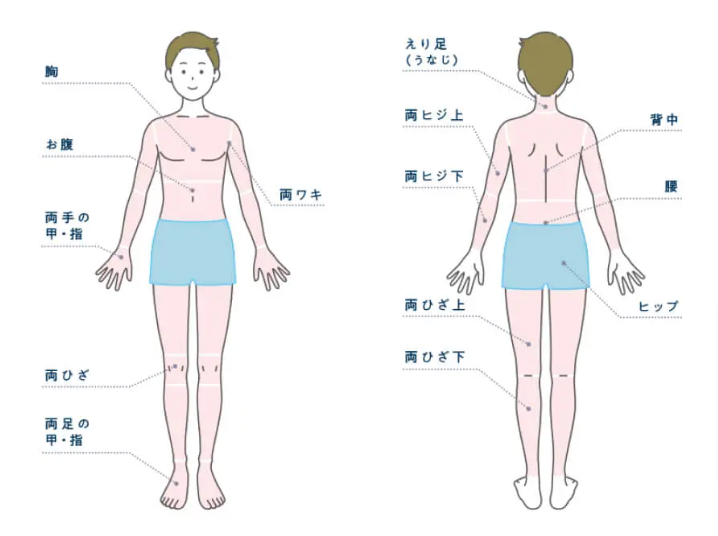 メンズじぶんクリニックの全身脱毛