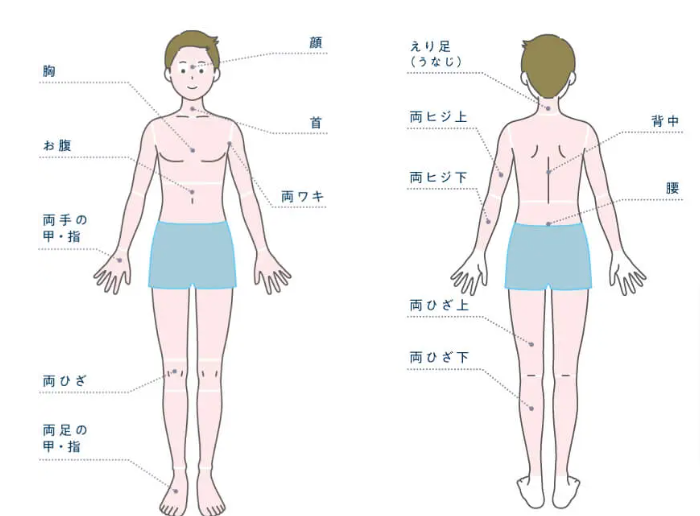 メンズじぶんクリニックの全身＋顔脱毛