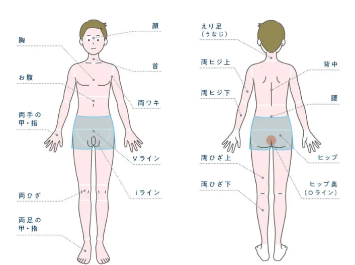 メンズじぶんクリニックの全身＋顔＋VIO脱毛