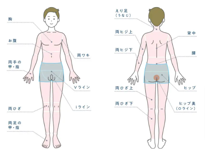 メンズじぶんクリニックの全身＋VIO脱毛